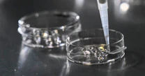 After Alabama IVF ruling, doctors warn that freezing embryos is essential for in vitro fertilization