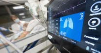 Latino patients with respiratory illnesses are 5 times more likely to be oversedated