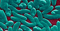 Four people have died from flesh-eating bacteria in Florida. Who is at risk? 