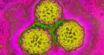 Cancer caused by HPV is increasing in some women in the U.S.