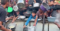 UN: 9% of Gaza’s children have severe malnutrition