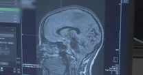 New technology offers hope for Parkinson’s patients