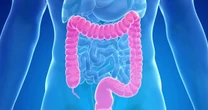 New blood test is added an an option for colorectal cancer screenings