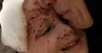 Inside a Beirut hospital treating wounded children