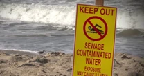 Study finds sewage, pollution from Mexican river poses health risk to Americans