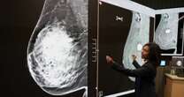 New mammogram could detect more breast cancers