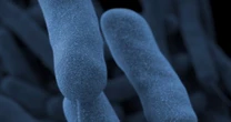 Nationwide concerns over deadly Legionnaires’ disease outbreak