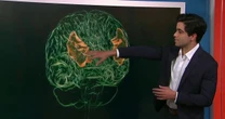AI brain implant helps stroke survivor communicate in English and Spanish