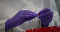 New CDC data shows up to 39 states are seeing a rise in Covid cases