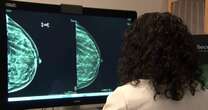 Some insurance companies denying additional breast cancer screenings