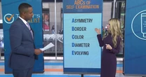 Skin Cancer Prevention Tips: Self-Examination, Sunscreen, More