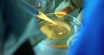 Breakthrough Genetic Screening Offers New IVF Hope for Families