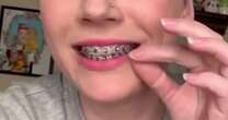 D-I-Why?? Dental experts warn against do-it-yourself braces