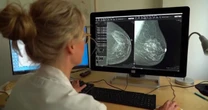 New AI Tool Can Predict Breast Cancer Risk