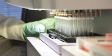 New Alzheimer's drug not for most dementia patients, docs say