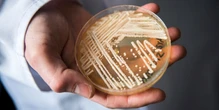 'Superbug' fungus spread in two cities, health officials say