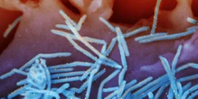 Virus that usually spreads in cold weather sending babies to the hospital in summer
