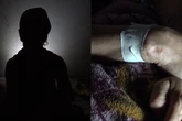Mulher sobrevive após ser estrangulada e enterrada viva por ex-companheiro