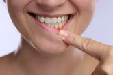 Você ignora esse sinal ao escovar os dentes? Médicos alertam para risco que vai além da boca