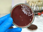 Dois novos surtos de 'superfungo' faz Anvisa emitir alerta de risco