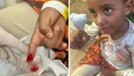 Criança é atacada por piranhas e perde parte do dedo na Bahia: 'Muito sangue'