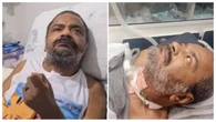 Veja quais foram as sequelas enfrentadas por Arlindo Cruz após o AVC hemorrágico