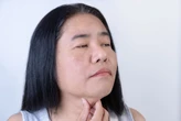 Celulite facial: o que é, sintomas e como prevenir a infecção que pode afetar o rosto