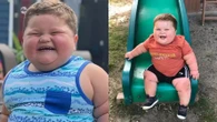 Doença rara faz criança de 3 anos pesar 45 kg e chorar de fome o dia inteiro