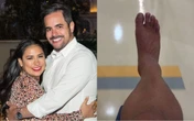 Kaká Diniz acompanha Simone Mendes ao hospital e também precisa de atendimento; saiba o que aconteceu