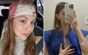 Aos 25 anos, Bruna Furlan desabafa após primeira radioterapia contra câncer: 'Chorei o dia todo'