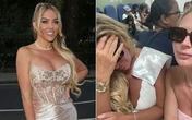 Ex-Big Brother sofre ataque de cachorro, fica com cicatrizes e recebe ameaças na web