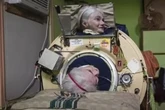 Ela viveu mais de 70 anos usando um pulmão de aço após contrair doença na infância