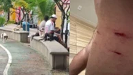 Cães de rua atacam em grupo moradores e fazem mais de 30 vítimas