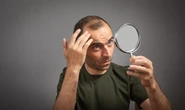 Sem efeito colateral: estudo revela que adoçante natural combate a calvície e faz o cabelo crescer 3x mais que o minoxidil
