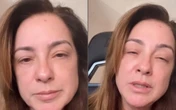 Mulher que espremeu 'espinha' que não cicatrizava nunca descobre câncer e faz alerta