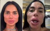 Kamila Simioni surpreende ao mostrar nova harmonização facial: 'A boca dos sonhos'