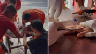 Bombeiros retiram anel preso ao dedo de jovem na Bahia