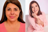 Mara Maravilha realiza procedimento para rejuvenescer o rosto e surpreende