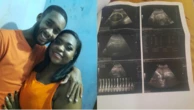 Nasce bebê de mulher que descobriu gravidez aos 9 meses na Bahia
