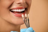 Saiba três riscos de usar lentes de contato para os dentes