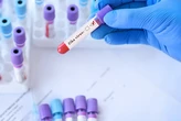 MP não é votada no prazo e famílias de crianças afetadas por zika vivem incerteza sobre indenização