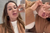 Maíra Cardi mostra deformações no rosto após aplicação de PMMA e desabafa: 'Parece que vai rasgar a pele'