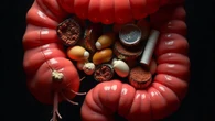 Câncer de intestino: 5 sinais que o seu corpo dá e você ignora