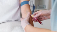 Pessoas com esse tipo sanguíneo envelhecem mais lentamente do que as outras, revela nova pesquisa