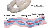 Cordão umbilical: o que acontece se esses três furinhos não funcionam bem?