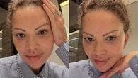 Aos 51 anos, Solange Almeida celebra resultado de lifting facial; veja antes e depois