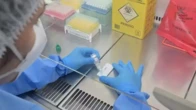 Ebola? Pacientes que passaram por áreas com surto são investigados no Brasil