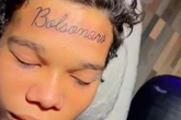 Jovem se arrepende e remove tatuagem de Bolsonaro na testa: 'Minha família toda vota no Lula'