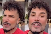 Latino exibe resultado de harmonização facial em evento; veja vídeo