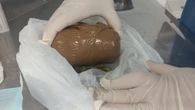 Grávida passa mal ao tentar entrar com drogas nas partes íntimas em presídio e acaba se entregando